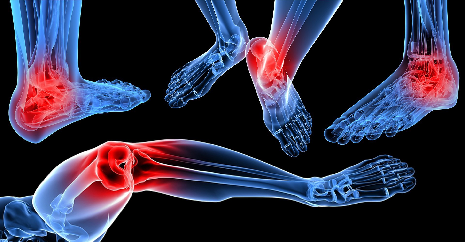 Foot and Ankle Injuries calgary Alberta